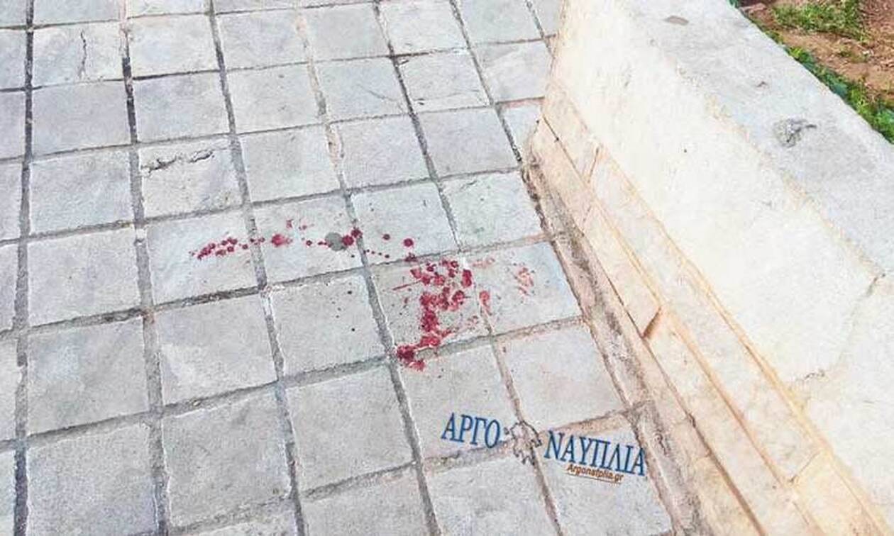 Ναύπλιο: Προσπάθησε να του κόψει το κεφάλι με αλυσοπρίονο