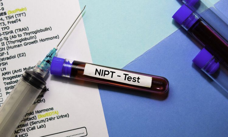 Μη επεµβατικός προγεννητικός έλεγχος: Τι μας αποκαλύπτει και σε ποιες περιπτώσεις ενδείκνυται