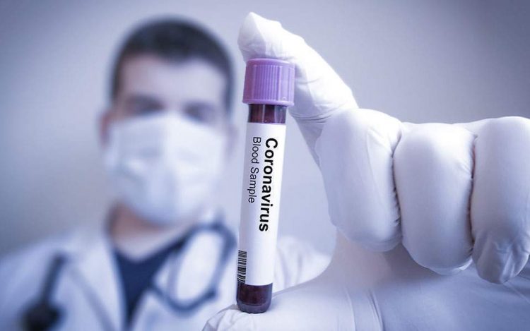 Δειγματοληπτικός έλεγχος σε υπαλλήλους της Τεχνικής Υπηρεσίας του Δήμου Μετεώρων