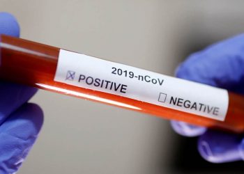 7 τα νέα κρούσματα στα Τρίκαλα το τελευταίο 24ωρο- 56 συνολικά στη Θεσσαλία