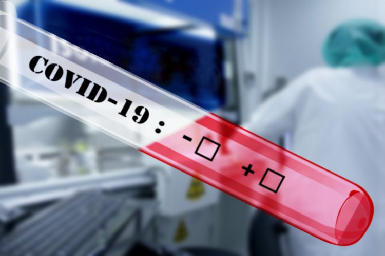 Αρνητικά τα τεστ COVID-19 σε δημοτικά σχολεία του Δήμου Φαρκαδόνας