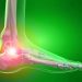 Oυρική Aρθρίτιδα (Αγγλικά Gouty Arthritis, ή Gout)- Ποδάγρα
