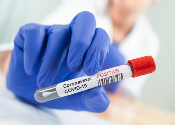 Μοριακά Τεστ κορωνοϊού (COVID-19) για όλους τους εργαζομένους του Δήμου Φαρκαδόνας