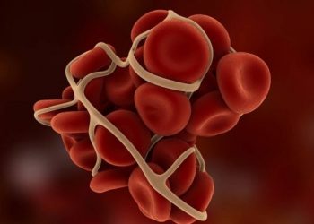 Θρόμβος στο πόδι: 5 τροφές που τον προλαμβάνουν