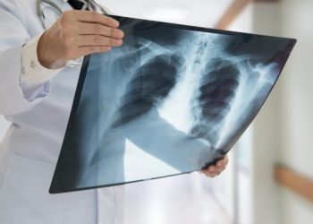 Καρκίνος πνευμόνων: 8 Ασυνήθιστα συμπτώματα που πρέπει να γνωρίζετε