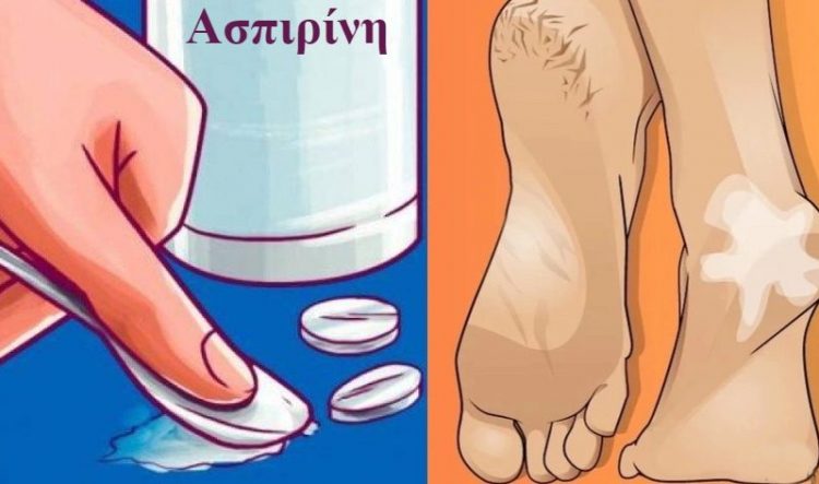 Ασπιρίνη: Οι εναλλακτικές χρήσεις της που δεν γνωρίζαμε μέχρι σήμερα