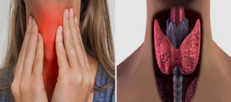 Υποξεία θυρεοειδίτιδα: Τι είναι, πότε εμφανίζεται και με ποια συμπτώματα εκδηλώνεται