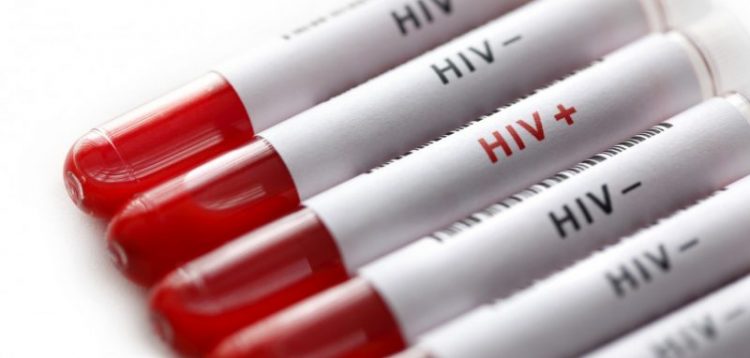 HPV: Όλα τα συμπτώματα- Η διάγνωση και η θεραπεία που κάθε γυναίκα πρέπει να ξέρει