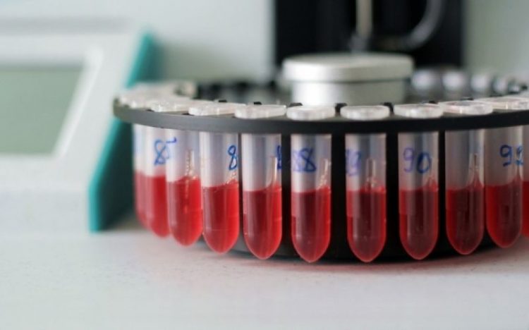 Ινστιτούτο Δημόσιας Υγείας: Ποιότητα κι ασφάλεια του αίματος σε έκτακτες καταστάσεις το θέμα της επόμενης διάλεξης