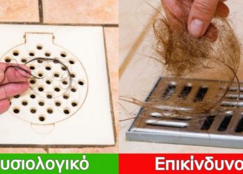 7 σημάδια που δείχνουν πως έχετε υπερβολική τριχόπτωση και οι τρόποι για να το καταλάβετε πριν είναι αργά