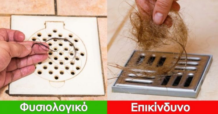 7 σημάδια που δείχνουν πως έχετε υπερβολική τριχόπτωση και οι τρόποι για να το καταλάβετε πριν είναι αργά