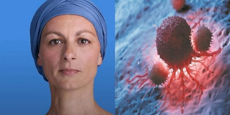Καρκίνος: 9 συνήθειες που μειώνουν τις πιθανότητες θανάτου- Τι να προσέξετε και στη διατροφή σας