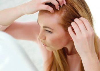 Πέντε φυσικοί τρόποι να καταπολεμήσετε την πιτυρίδα