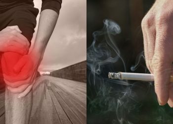 Αρθρίτιδα: Προκαλεί φλεγμονή και πόνο – Οι παράγοντες που επιβαρύνουν τις αρθρώσεις σας