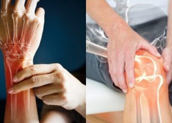 Ρευματοειδής αρθρίτιδα: Φυσικές λύσεις για να μειώσετε τους πόνους
