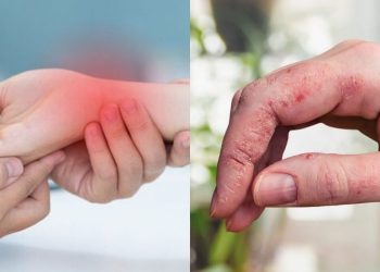Σημάδια ασθένειας στα χέρια: Ποιες σοβαρές παθήσεις φανερώνουν