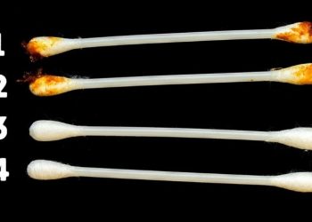 8 σημάδια στα αυτιά που φανερώνουν την κατάσταση της υγείας μας και δεν πρέπει να αγνοήσουμε