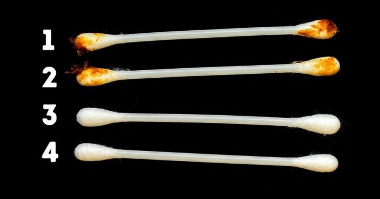 8 σημάδια στα αυτιά που φανερώνουν την κατάσταση της υγείας μας και δεν πρέπει να αγνοήσουμε