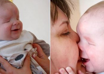 Το μωρό χωρίς μάτια βρήκε σπίτι – Το εγκατέλειψε η μητέρα του μόλις γεννήθηκε