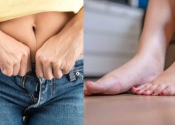 Κατακράτηση υγρών: Τα συμπτώματα και Πώς θα την αντιμετωπίσετε