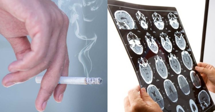 Κάπνισμα: Ποια είναι η κατάλληλη ηλικία για να κόψετε το τσιγάρο – Τι ρόλο παίζει – Δείτε γιατί