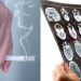 Κάπνισμα: Ποια είναι η κατάλληλη ηλικία για να κόψετε το τσιγάρο – Τι ρόλο παίζει – Δείτε γιατί