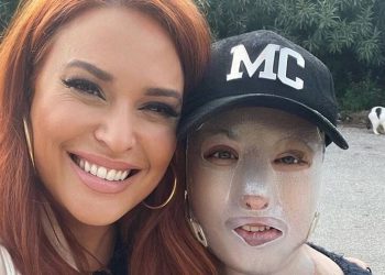 Η Ιωάννα Παλιοσπύρου δείχνει τα λιωμένα ρούχα από την ημέρα της επίθεσης με το βιτριόλι