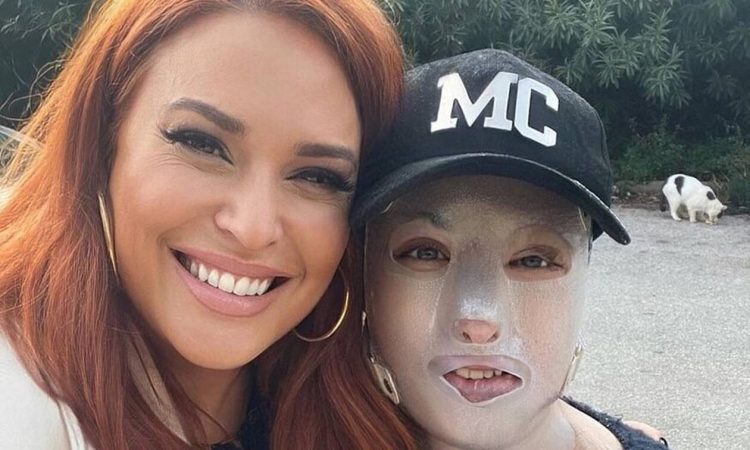 Η Ιωάννα Παλιοσπύρου δείχνει τα λιωμένα ρούχα από την ημέρα της επίθεσης με το βιτριόλι
