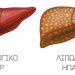 Λιπώδες ήπαρ: 7 προειδοποιητικά συμπτώματα – Βίντεο