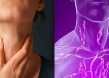 Διογκωμένοι – Πρησμένοι λεμφαδένες: 12 προβλήματα υγείας που φανερώνουν – Τι είναι η λεμφαδενοπάθεια