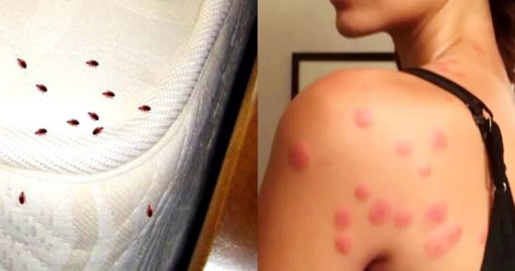 Κοριοί σε στρώματα, κρεβάτια και ρούχα: Ο δύσκολος εντοπισμός τους και η λύση για την εξαφάνισή τους