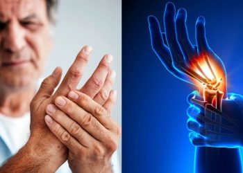 Ρευματοειδής αρθρίτιδα και αυτοάνοσες παθήσεις του εντέρου: Ένας αναπάντεχος παράγοντας κινδύνου