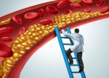 Στένωση αρτηριών: Τι να τρώτε και τι να αποφεύγετε .. να αναστρέψετε την καρδιακή νόσο