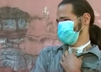 Πύργος: Αγωνία για την εξαφάνιση του Θύμιου – Πώς ήταν πριν το ατύχημα που τον παραμόρφωσε