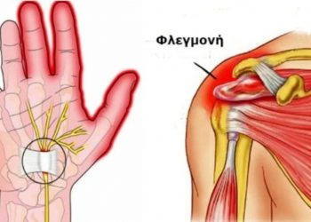 Χρόνια φλεγμονή: Έτσι θα την μειώσετε φυσικά
