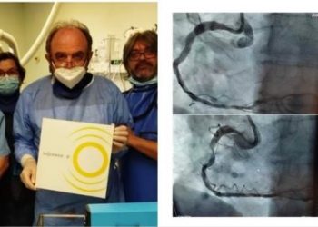 Με επιτυχία το 1ο περιστατικό αγγειοπλαστικής με χρήση μπαλονιού ενδαγγειακής λιθοτριψίας στο Αιμοδυναμικό εργαστήριο του Γ.Ν.Τρικάλων