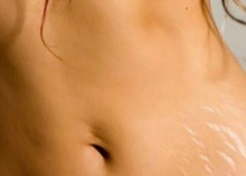 Ραγάδες: 3 χρυσά μυστικά για να απαλλαγείτε