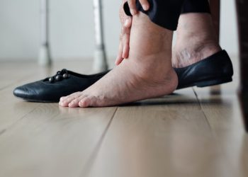 Έχετε πρησμένα πόδια τελευταία; Δείτε πού μπορεί να οφείλεται και πώς θα σας περάσει