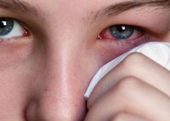 Είναι κριθαράκι ή χαλάζιο; Σε τι διαφέρουν – Αίτια, συμπτώματα, θεραπεία και πρόληψη