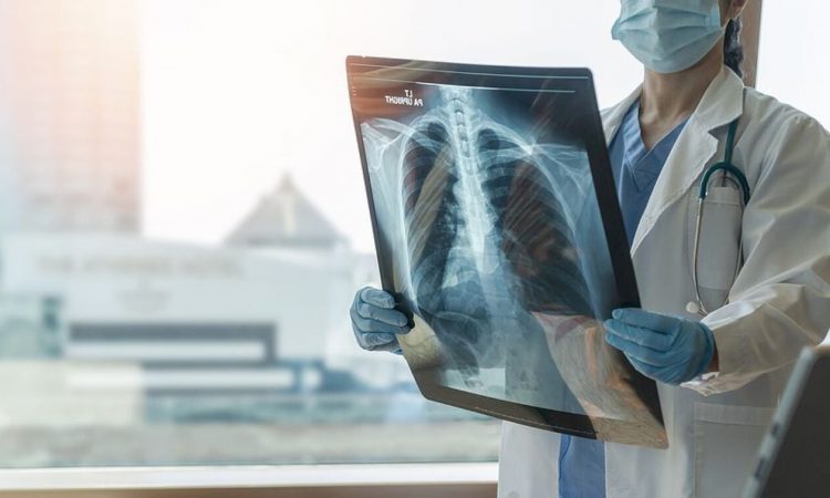 Ατμοσφαιρική ρύπανση: Γιατί αυξάνει τον κίνδυνο για καρκίνο του πνεύμονα