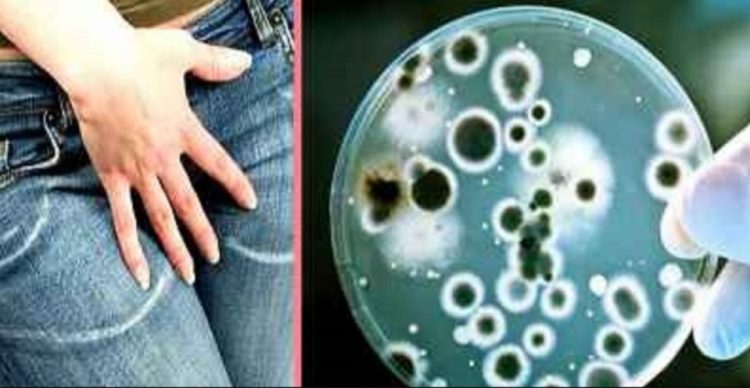 Κολπίτιδα από μύκητα Candida: Τι προκαλεί τις μολύνσεις ζύμης και πώς μπορείτε να απαλλαγείτε από αυτές