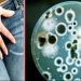 Κολπίτιδα από μύκητα Candida: Τι προκαλεί τις μολύνσεις ζύμης και πώς μπορείτε να απαλλαγείτε από αυτές