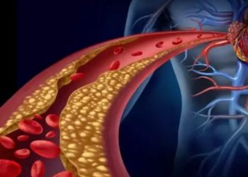 5 top τρόφιμα που ρίχνουν τη χοληστερόλη