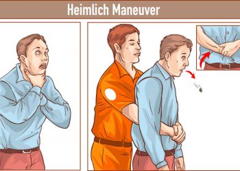 Πνίγεται κάποιος; Μάθε βήμα βήμα τη λαβή Heimlich για να μπορείς να βοηθήσεις