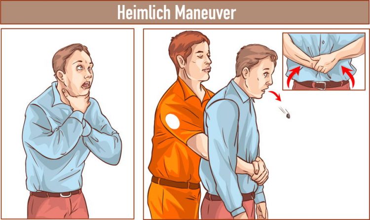 Πνίγεται κάποιος; Μάθε βήμα βήμα τη λαβή Heimlich για να μπορείς να βοηθήσεις