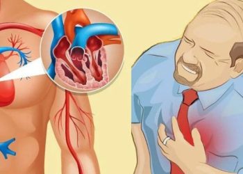 Χιλιάδες ασθενείς κινδυνεύουν από έμφραγμα λόγω της πανδημίας, προειδοποιούν οι καρδιολόγοι