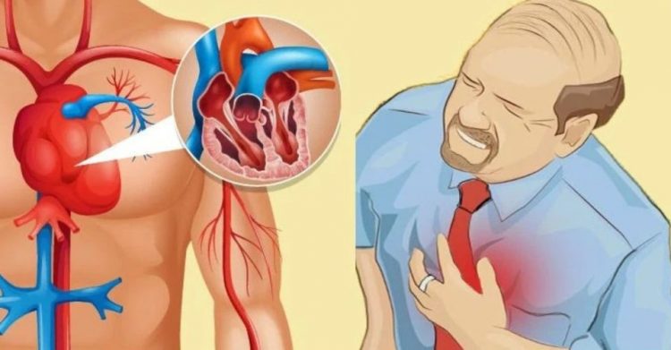 Χιλιάδες ασθενείς κινδυνεύουν από έμφραγμα λόγω της πανδημίας, προειδοποιούν οι καρδιολόγοι