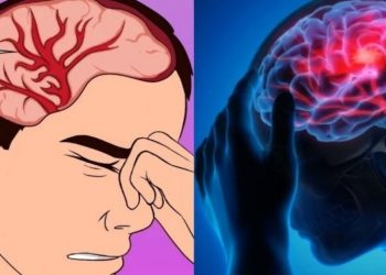 Σιωπηλό εγκεφαλικό: Πώς καταλαβαίνει ο ασθενής – Σε τι διαφέρει το μίνι εγκεφαλικό από το σιωπηλό