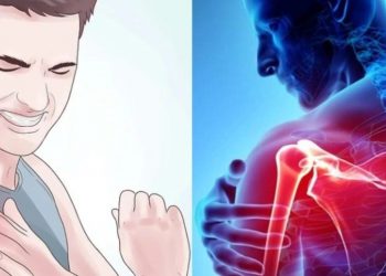 Αρθρίτιδα – μείωση της φλεγμονής: Τροφές που πυροδοτούν τη φλεγμονή και πρέπει να αποφεύγετε