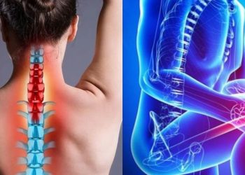 13 Τρόποι για να Σταματήσετε την Οστεοπόρωση και να Ενισχύσετε τα Οστά Σας !